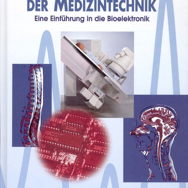 Keine Angst vor der Medizintechnik (E-book)